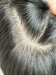 5″x6″Invisible edge Silk Top Permed Wavy 100% Remy Human Hair Topper 12″~18″
